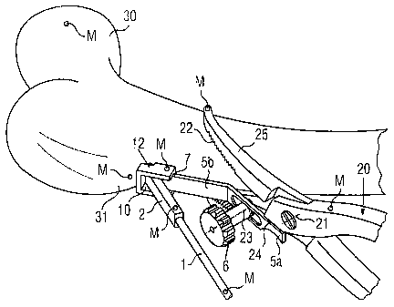 Une figure unique qui représente un dessin illustrant l'invention.